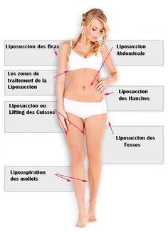 liposuccion 