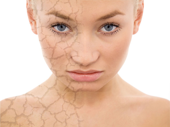 cicatrices-apres-lifting-visage