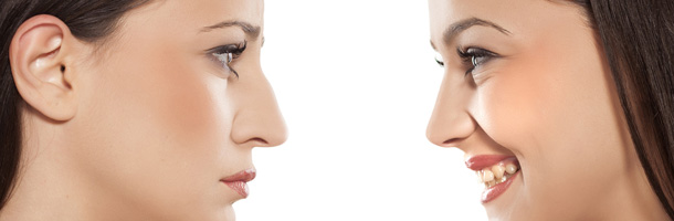 chirurgie esthétique de rhinoplastie