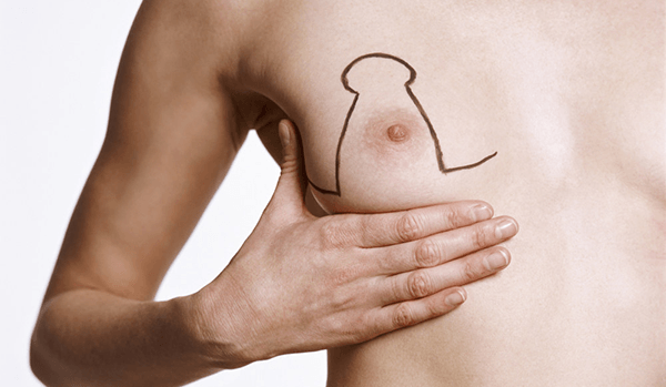 Lipofilling mammaire