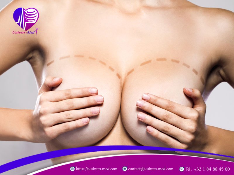 La transplantation des graisses dans les seins favorise plusieurs corrections