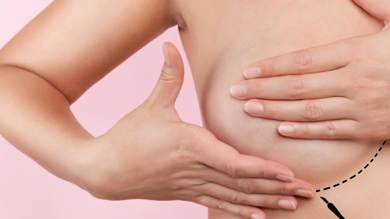 Rivalité entre lipofilling et produits de comblement