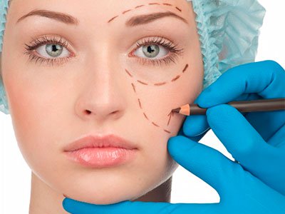 chirurgie esthetique