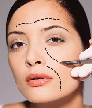 lifting-cervico-facial