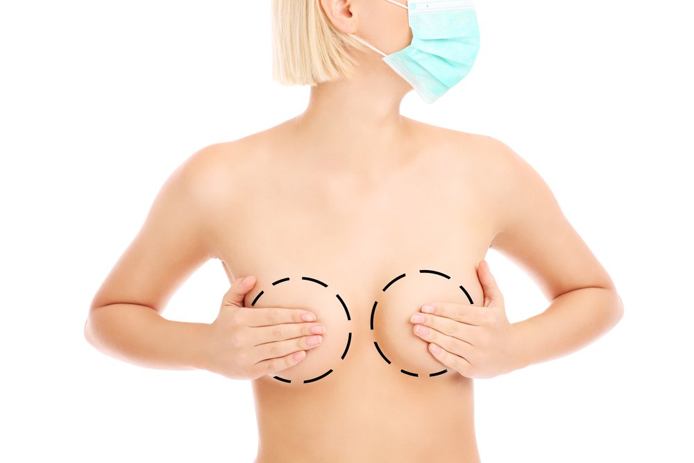 lipofilling-mammaire