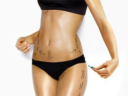 la liposuccion, implants fessiers et lipofiling fessier