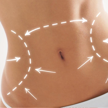 abdominoplastie tunisie