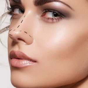 https://www.tunisie-chirurgie-esthetique.org/rhinoplastie.html